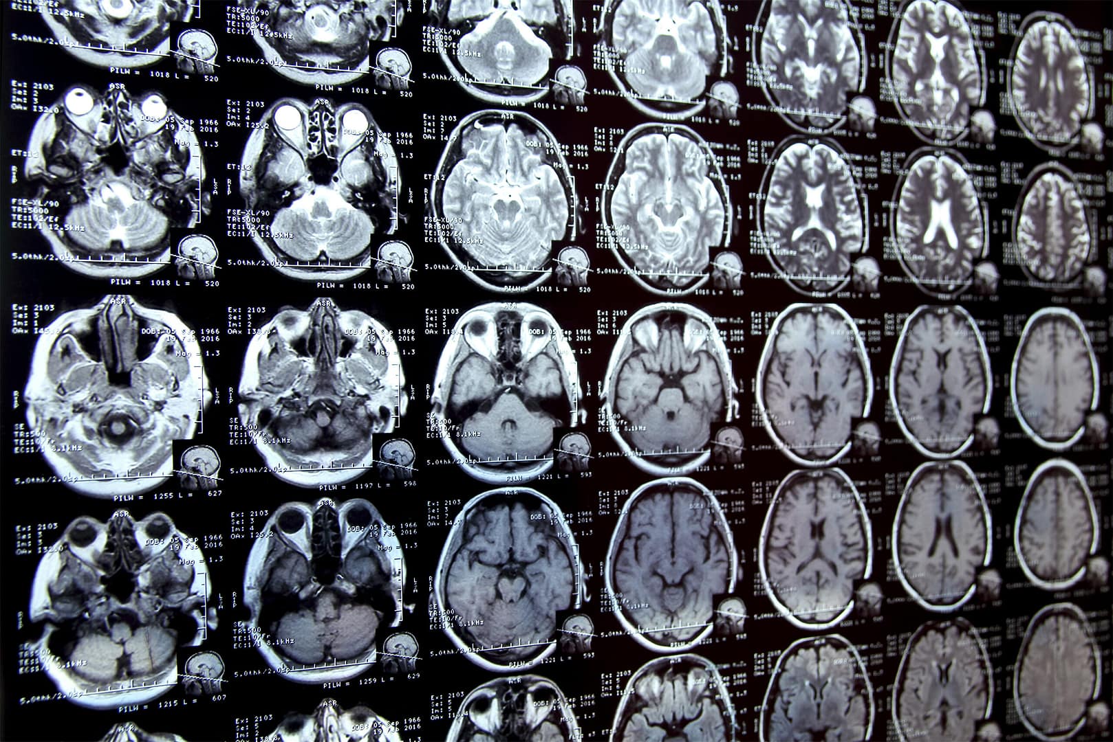 New AI system could accelerate clinical research New AI system could accelerate clinical research